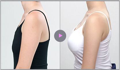 楊瀚城醫(yī)生_資料簡(jiǎn)介_(kāi)案例圖_成都莊醫(yī)生醫(yī)學(xué)美容