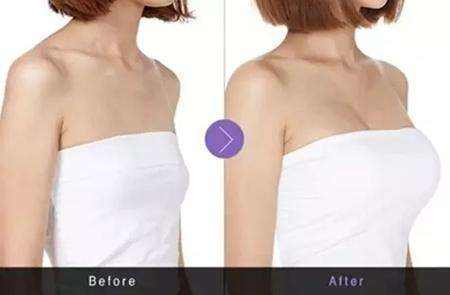 楊瀚城醫(yī)生_資料簡(jiǎn)介_(kāi)案例圖_成都莊醫(yī)生醫(yī)學(xué)美容