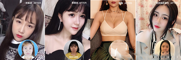 成都潤美玉光巖整形美容醫(yī)院案例分析