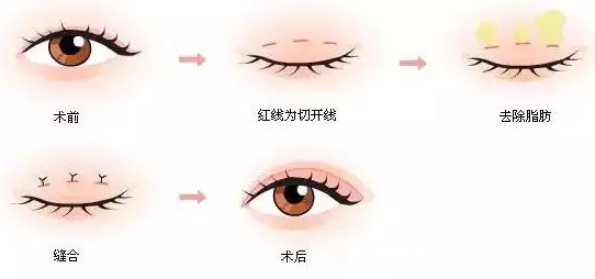 長春萊美prp自體細(xì)胞