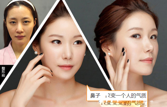 眼部手術征眼部手術征