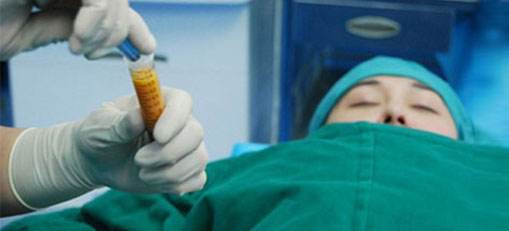 脂肪填充后的針眼疤痕，該怎樣清除？