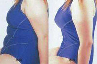腰腹部環(huán)吸+大腿吸脂手術(shù)，讓人體會截然不同的你~