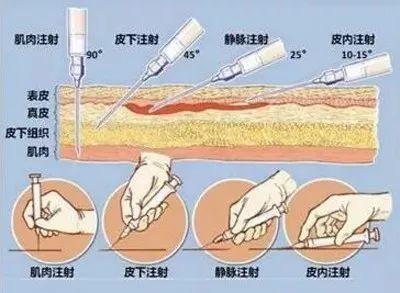 給你們瞧瞧玻尿酸注射的不良反應(yīng)，看完你還敢反復(fù)注射？