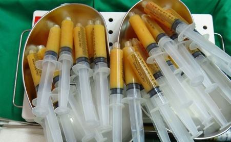 2019年腰部吸脂減肥價錢明細(xì)表，附吸脂圖