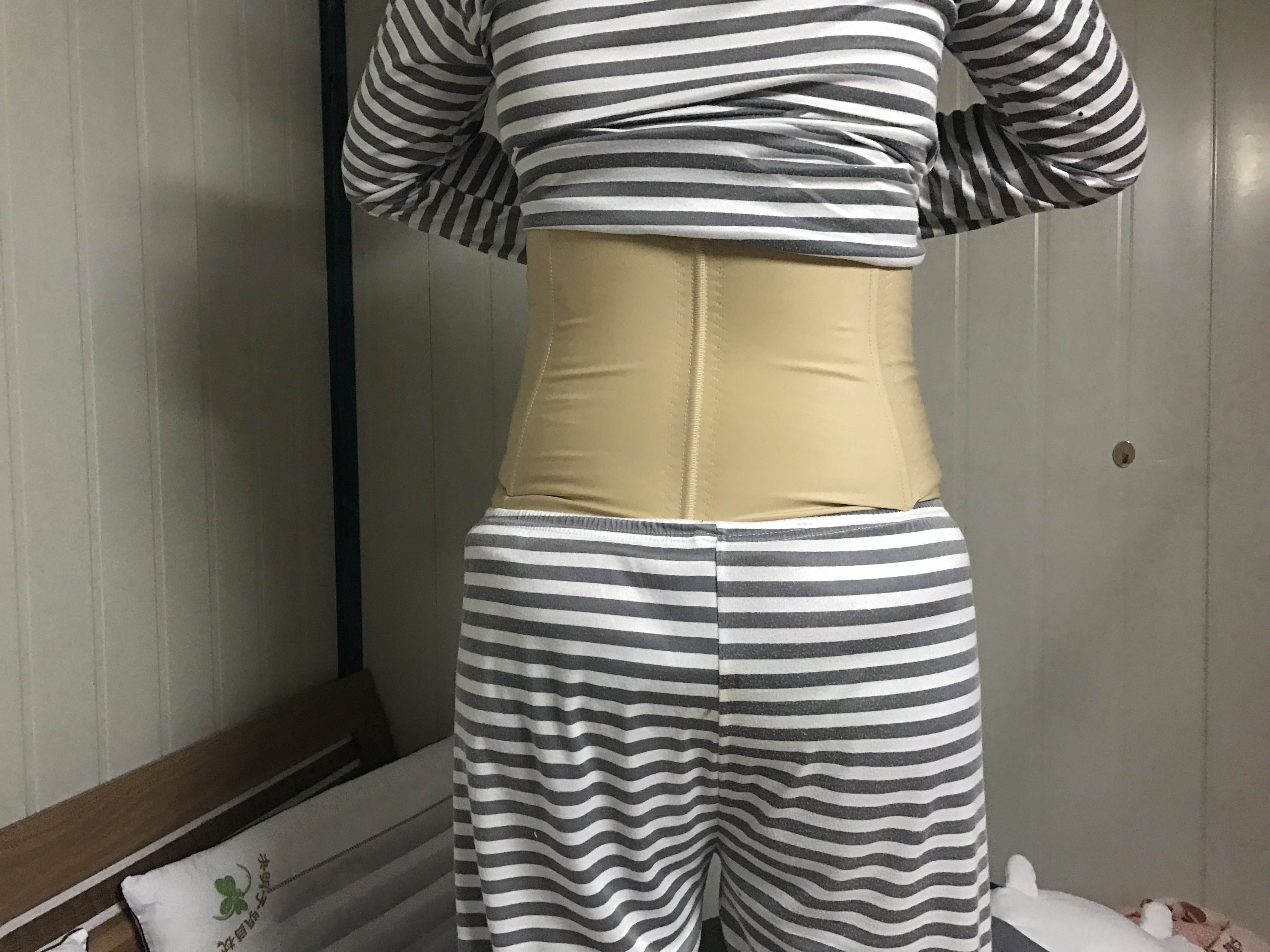 2019年腰部吸脂減肥價錢明細(xì)表，附吸脂圖