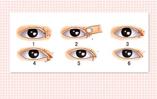 外眼角開大不令人滿意，能夠如何修復(fù)呢？