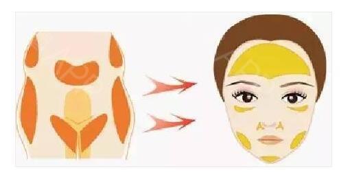 做完脂肪填充面部后擔(dān)心終成豬頭？消腫小妙招~