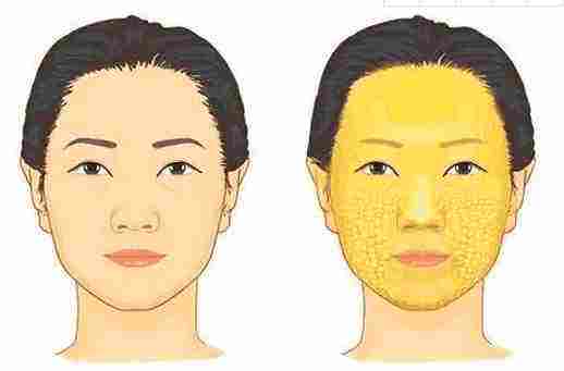 做完脂肪填充面部后擔(dān)心終成豬頭？消腫小妙招~