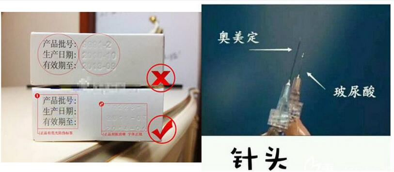 玻尿酸和奧美定產(chǎn)品包裝不同