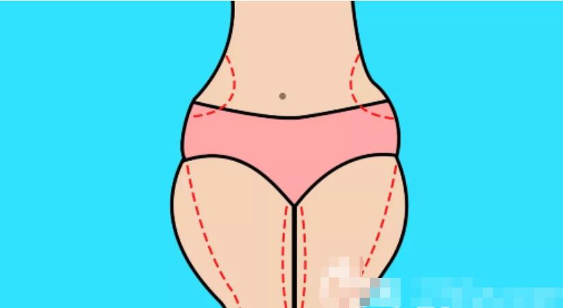 大腿吸脂手術(shù)