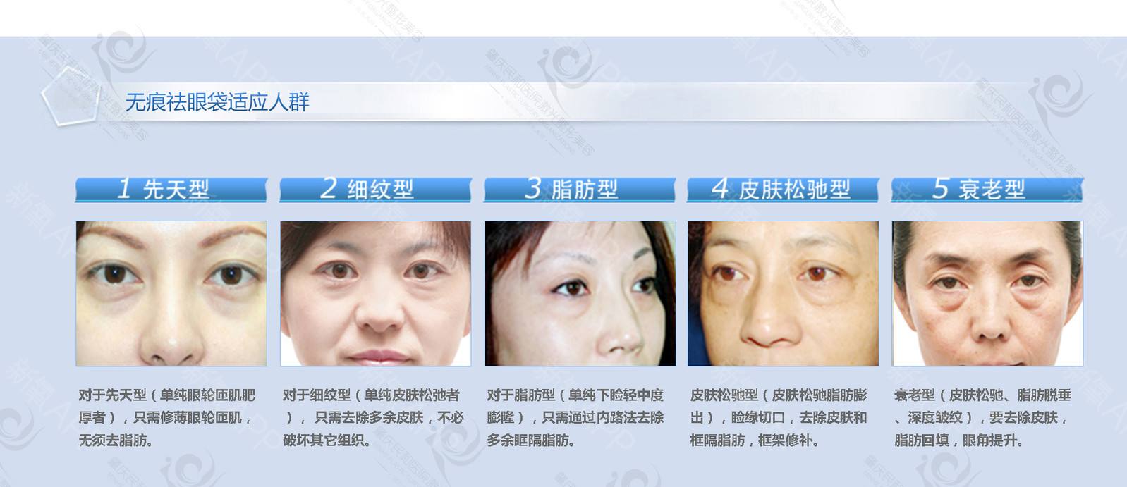 微創(chuàng)祛眼袋需要多少錢？它的基本原理和操作流程