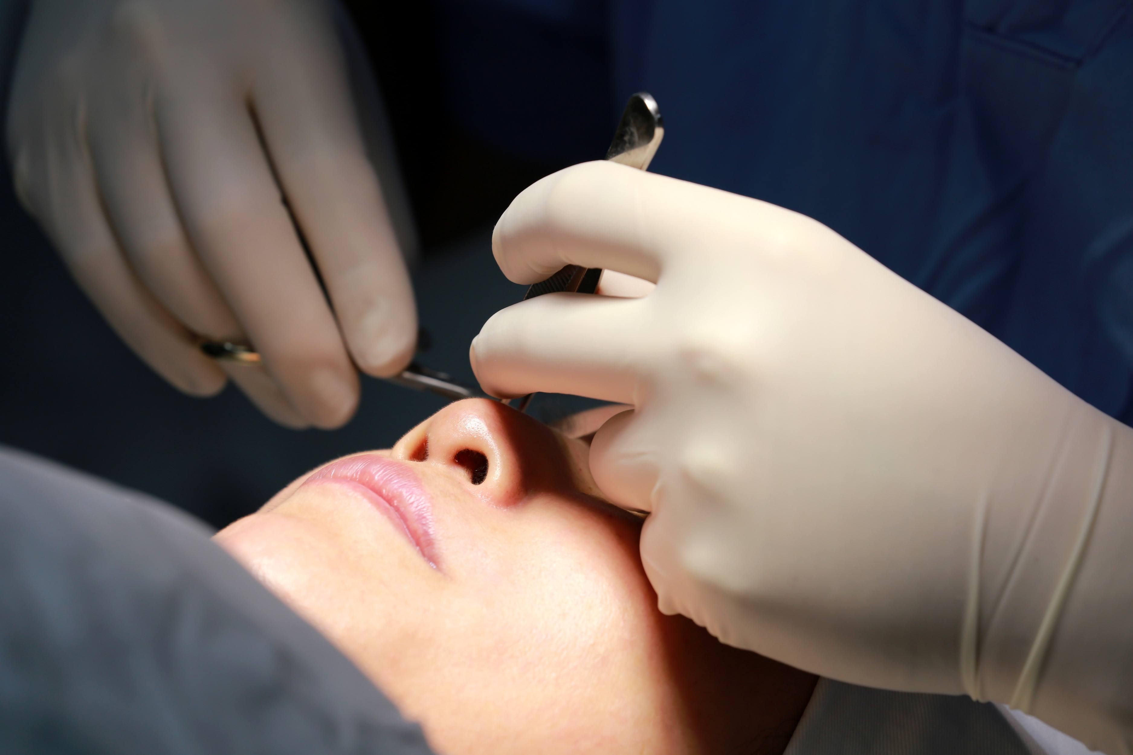 做雙眼皮需要多少錢(qián)？選擇一個(gè)知名度高的的醫(yī)師價(jià)錢(qián)貴嗎？