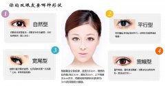 微創(chuàng)雙眼皮是如何做的？果能保持多長(zhǎng)時(shí)間？