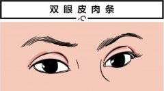 雙眼皮失敗較多能修復(fù)幾次？看專業(yè)醫(yī)美人士怎么說