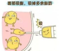 盤點一下，面部吸脂恢復期要多久？原來這才是小臉秘訣