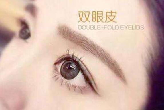 韓式重瞼術(shù)