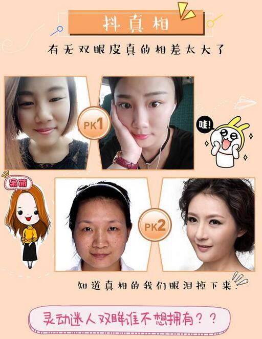 雙眼皮增生是如何引起的以及如何避免它?首先，我們需要找出雙眼皮增生的原因