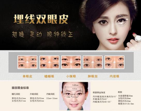 埋線法雙眼皮手術(shù)