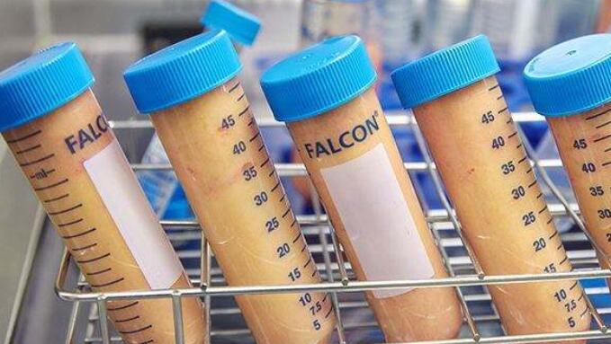 水動力吸脂方面有著嫻熟的手法,能夠平穩(wěn)快速且精細(xì)輕柔地把脂肪量吸出來