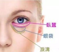 脂肪填充臥蠶能維持多久？看看這個臥蠶能“撐”多久