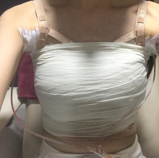 根據(jù)較新報道，韓國已經(jīng)出現(xiàn)了一個娜綺麗的病例