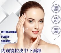 多方位分析內窺鏡除皺術，這些你認識多少？