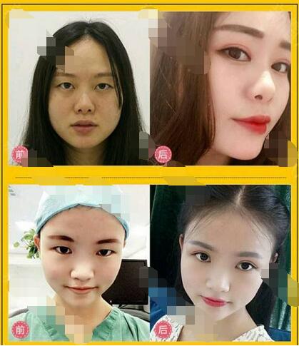 吳明瑞醫(yī)生案例圖