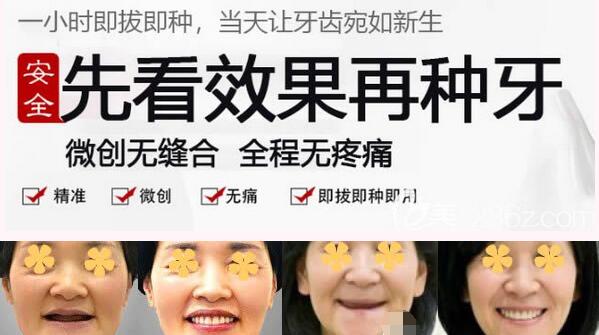 清華陽(yáng)光口腔醫(yī)院案例圖