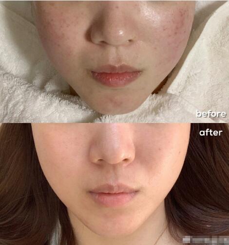 上海膚康醫(yī)院果圖