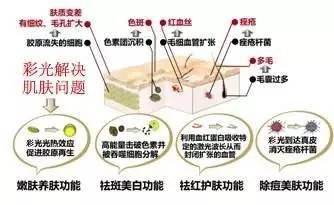 皮膚美容：彩光嫩膚和光子嫩膚有什么區(qū)別？哪個更好？