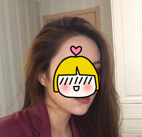 吸脂瘦臉手術(shù)果怎么樣？吸脂瘦臉和溶脂哪個好？