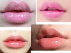 膠原蛋白豐唇價格和玻尿酸豐唇的價格哪個更劃算？