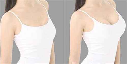 怕疼的人想問問沒多少痛感隆胸這種方法有沒有？