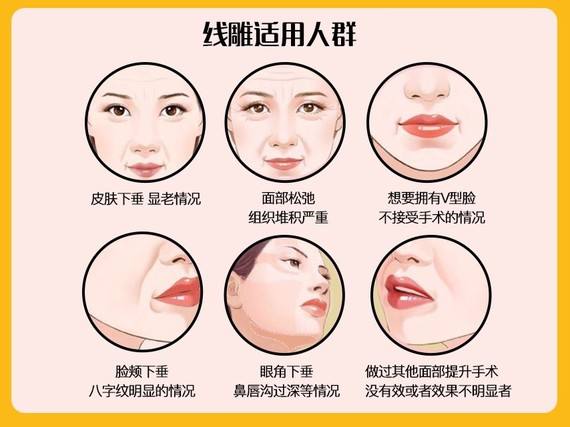 想知道北京面部提升多少錢？看一下詳細(xì)的數(shù)據(jù)