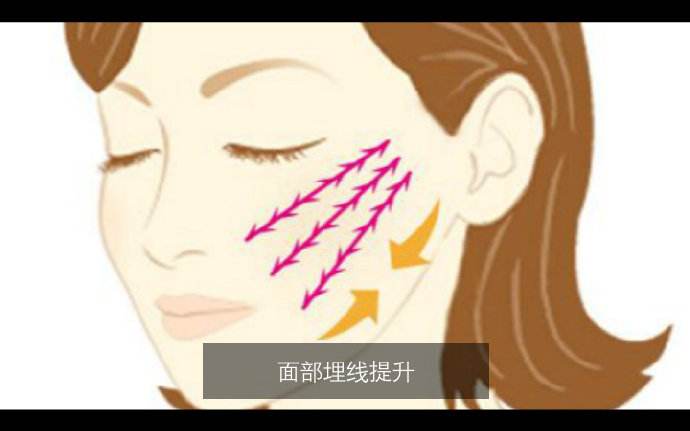 想知道北京面部提升多少錢？看一下詳細(xì)的數(shù)據(jù)