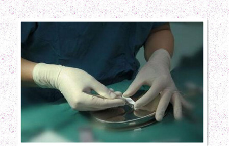 北京膨體隆鼻多少錢？聽說膨體容易感染是真的嗎？