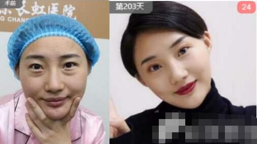 趙宏偉醫(yī)生案例圖