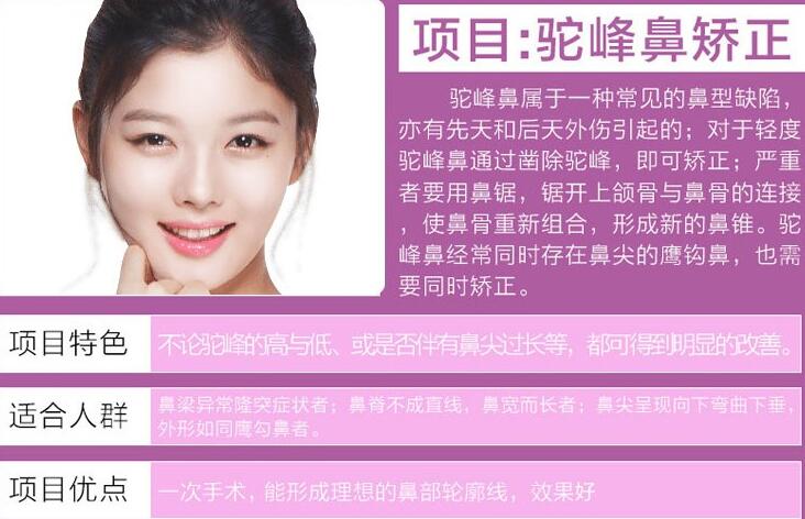 駝峰鼻修復(fù)知識全科普，來看看適合你嗎？