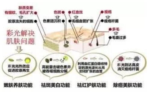彩光嫩膚祛斑的原理