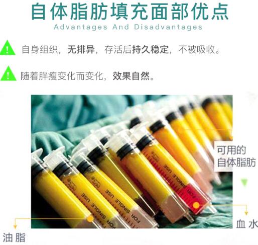 任學(xué)會(huì)脂肪填充好嗎？技術(shù)+案例圖鑒賞點(diǎn)評(píng)