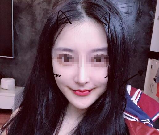 任學(xué)會(huì)脂肪填充果圖 全臉案例