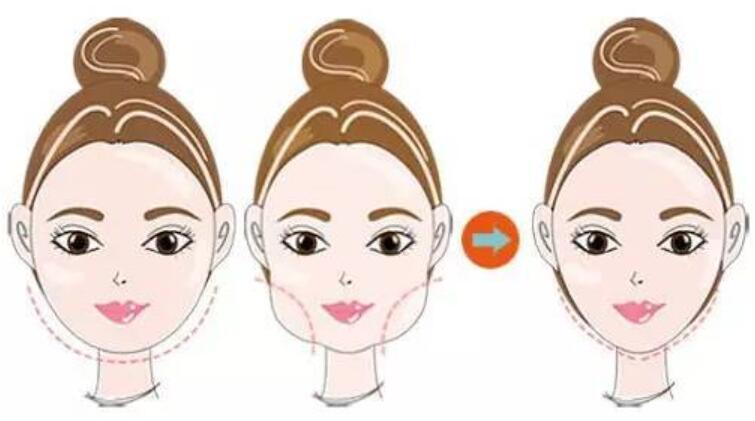 有很多下巴寬大的人，為了改變下把寬大這種狀況很多人會(huì)選擇去做下頜角磨骨手術(shù)