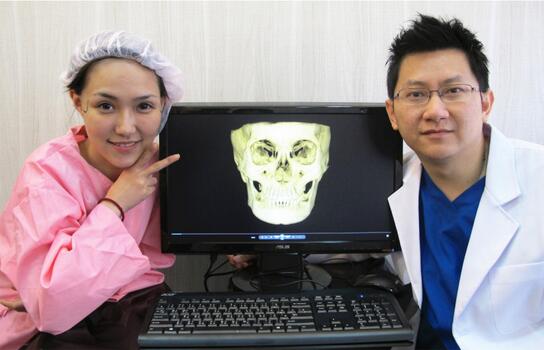 真實(shí)案例：下頜角截骨前后果對(duì)比果圖分享