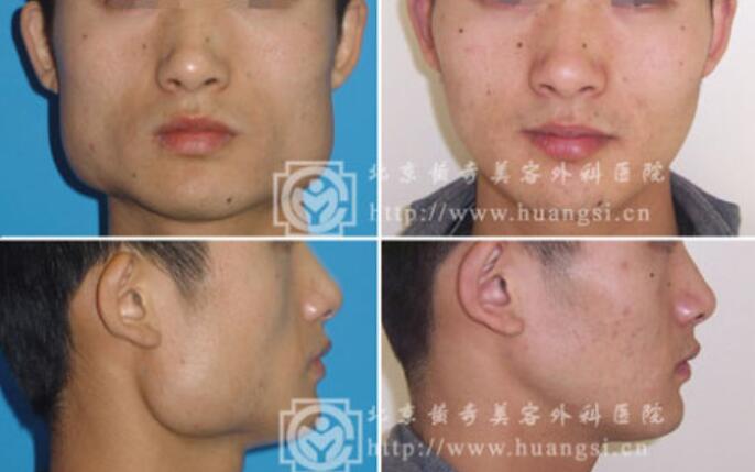 邵禎醫(yī)生案例圖