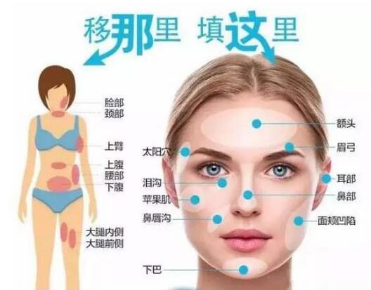 吸脂手術(shù)的醫(yī)院看準(zhǔn)這些標(biāo)準(zhǔn)，不踩坑！