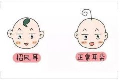 招風(fēng)耳手術(shù)多少錢(qián)?普通家庭能夠承受手術(shù)費(fèi)用嗎