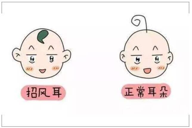 如果要進(jìn)行招風(fēng)耳手術(shù)調(diào)節(jié),那招風(fēng)耳手術(shù)多少錢(qián)呢