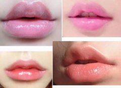 豐嘴唇用什么辦法比較好？玻尿酸or自體脂肪如何選擇