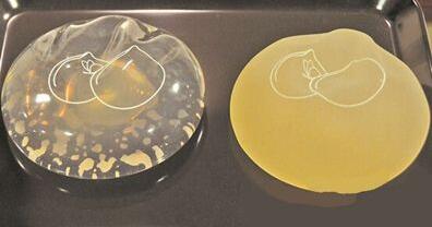 假體隆胸d罩大不大?